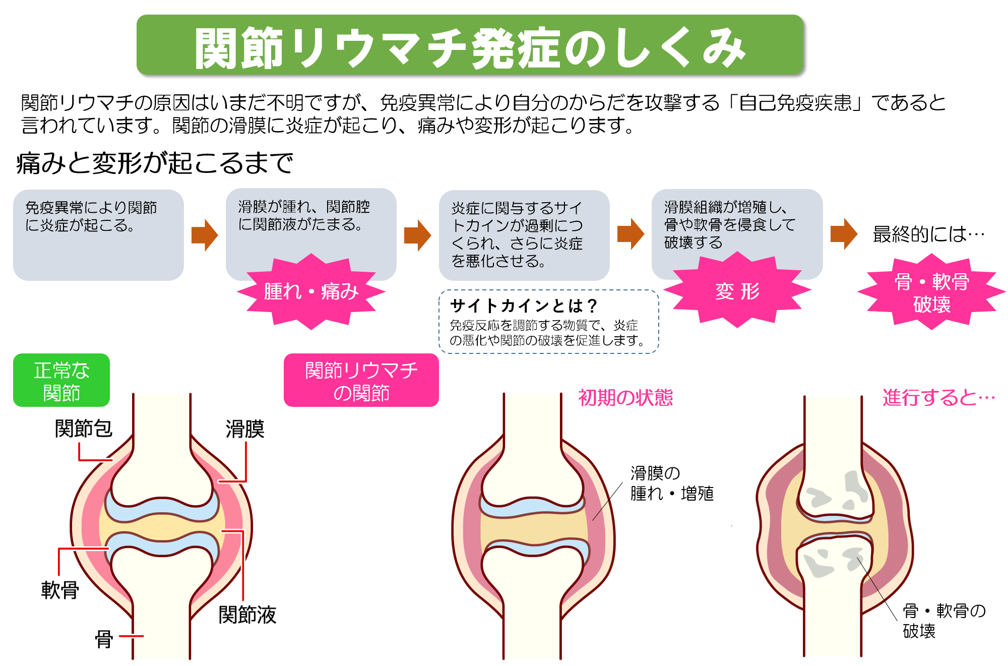  RAの治療にどのように役立ちますか?